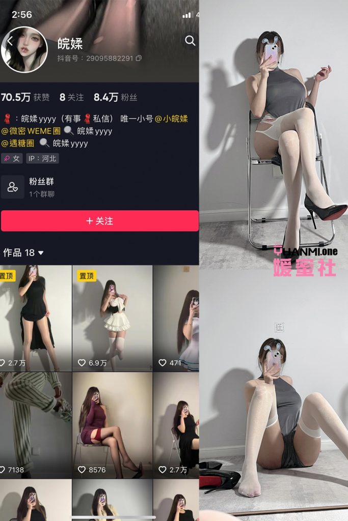 WWVIP-1 拷贝